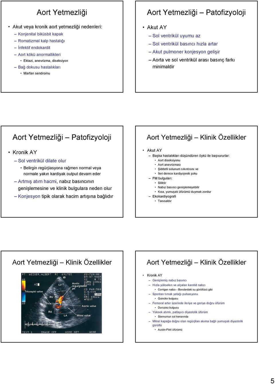 minimaldir Aort Yetmezliği Patofizyoloji Kronik AY Sol ventrikül dilate olur Belirgin regürjiasyona rağmen normal veya normale yakın kardiyak output devam eder Artmış atım hacmi, nabız basıncının