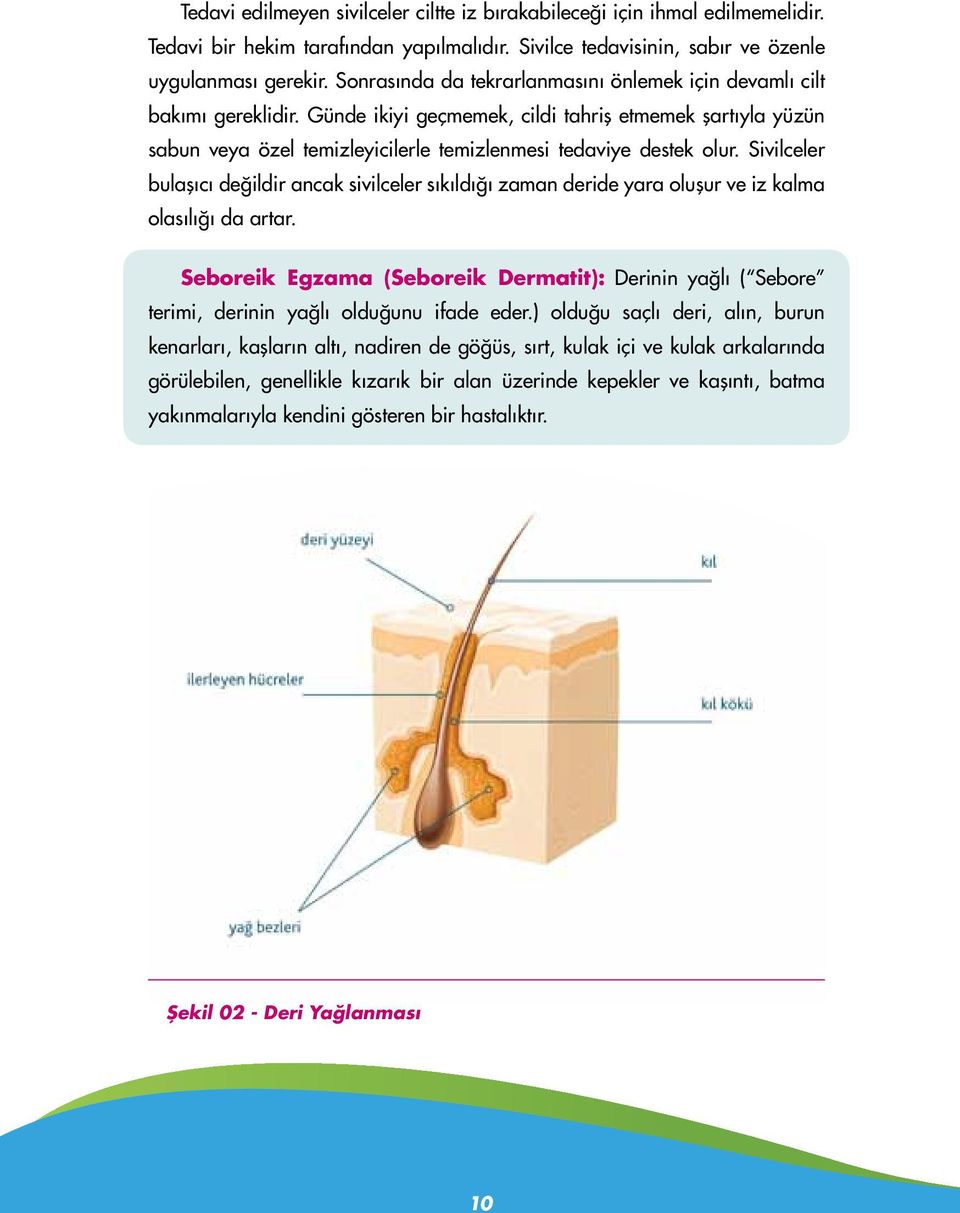 Sivilceler bulaşıcı değildir ancak sivilceler sıkıldığı zaman deride yara oluşur ve iz kalma olasılığı da artar.