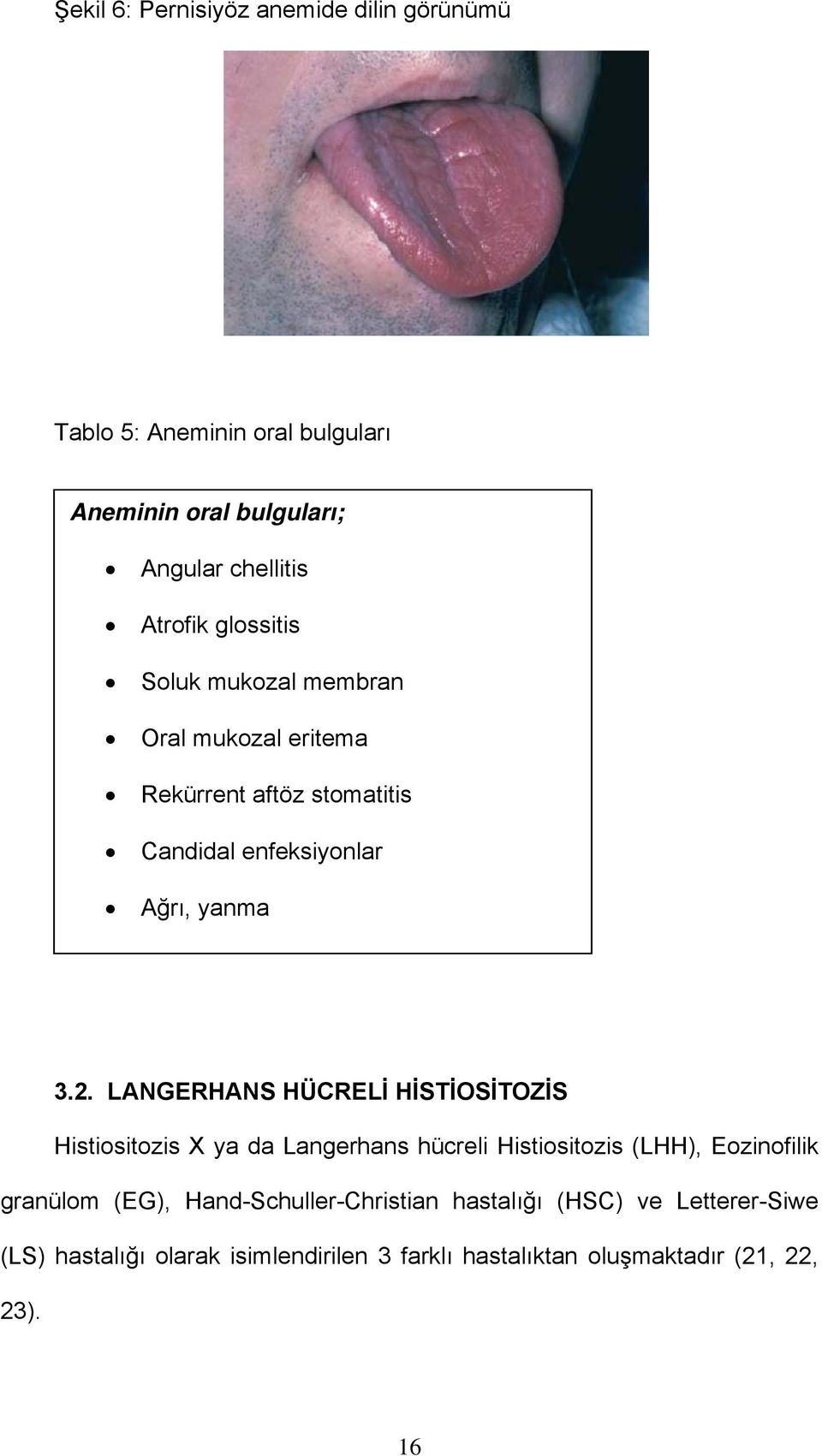 LANGERHANS HÜCRELİ HİSTİOSİTOZİS Histiositozis X ya da Langerhans hücreli Histiositozis (LHH), Eozinofilik granülom (EG),