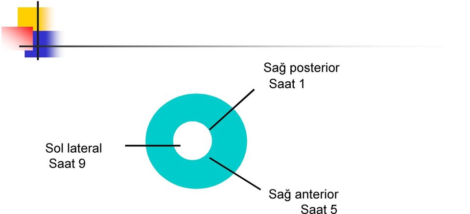 lateral Saat 9