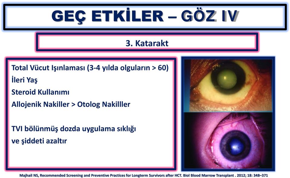 Allojenik Nakiller Otolog Nakilller TVI bölünmüş dozda uygulama sıklığı ve şiddeti