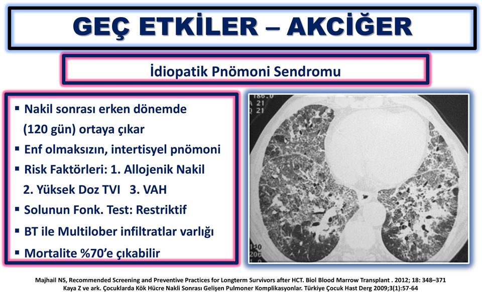 Test: Restriktif BT ile Multilober infiltratlar varlığı Mortalite %70 e çıkabilir Majhail NS, Recommended Screening and Preventive