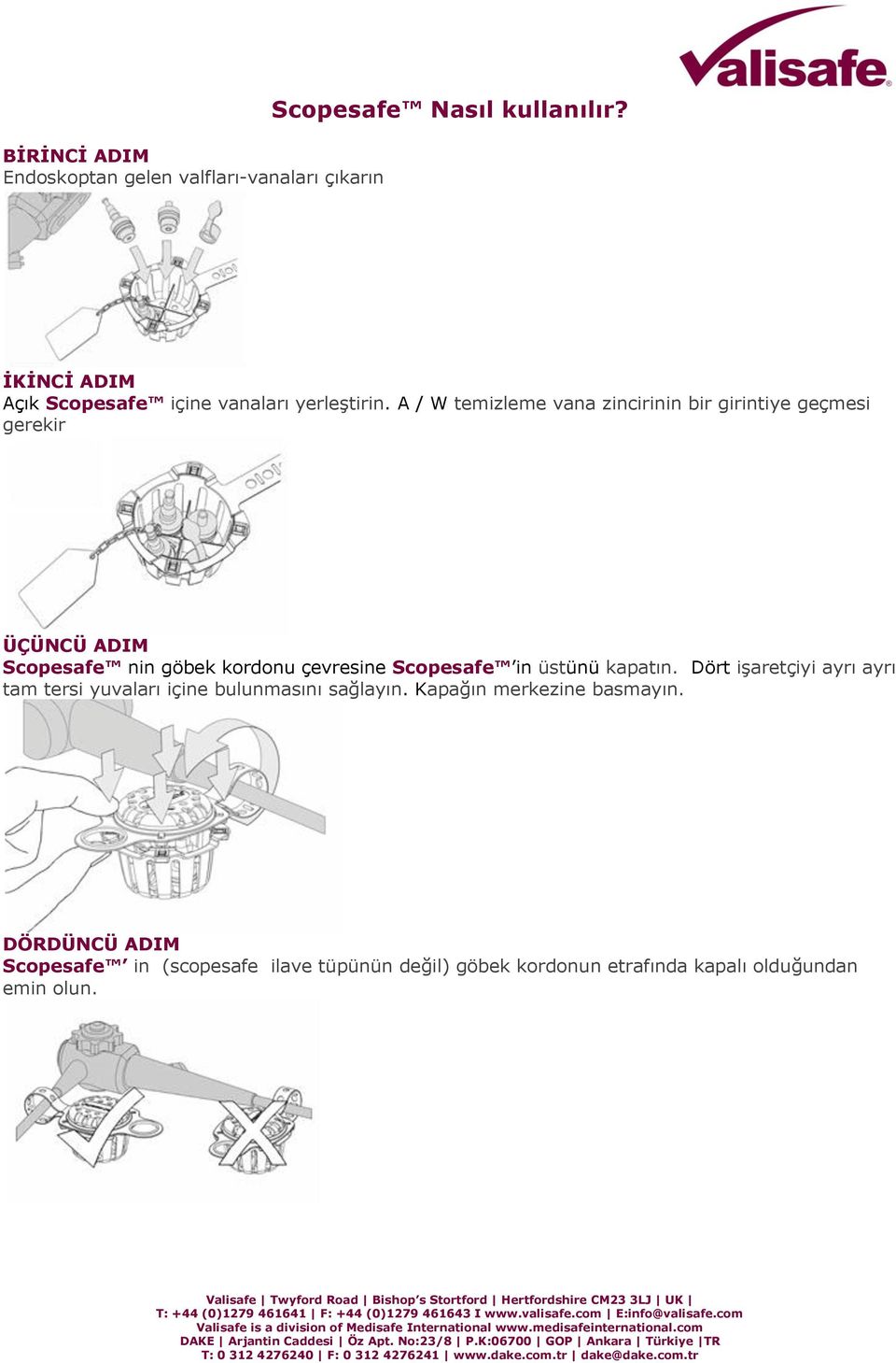 A / W temizleme vana zincirinin bir girintiye geçmesi gerekir ÜÇÜNCÜ ADIM Scopesafe nin göbek kordonu çevresine Scopesafe