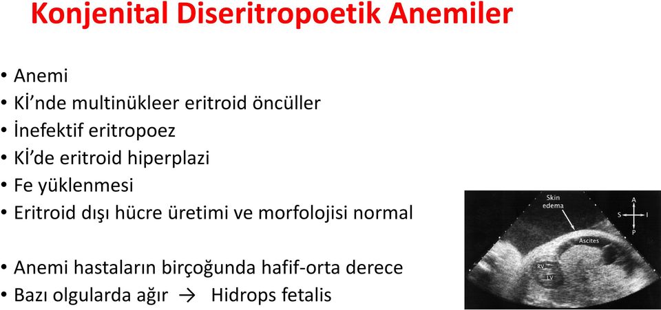 yüklenmesi Eritroid dışı hücre üretimi ve morfolojisi normal Anemi