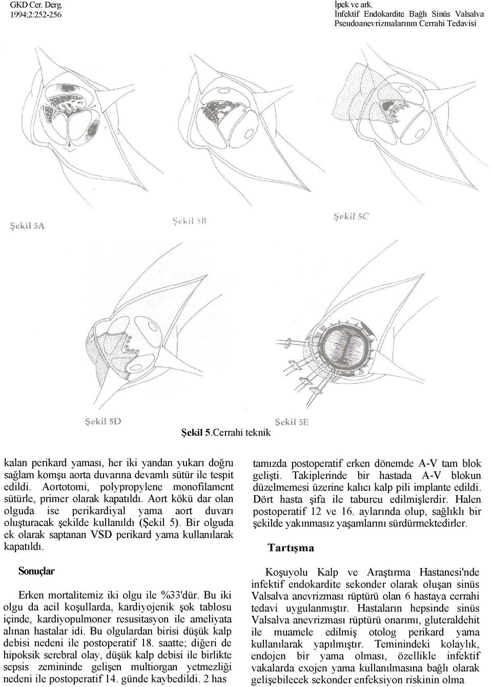 Bir oguda ek oarak saptanan VSD perikard yama kuanıarak kapatıdı. Sonuçar Erken mortaitemiz iki ogu ie %33'dür.