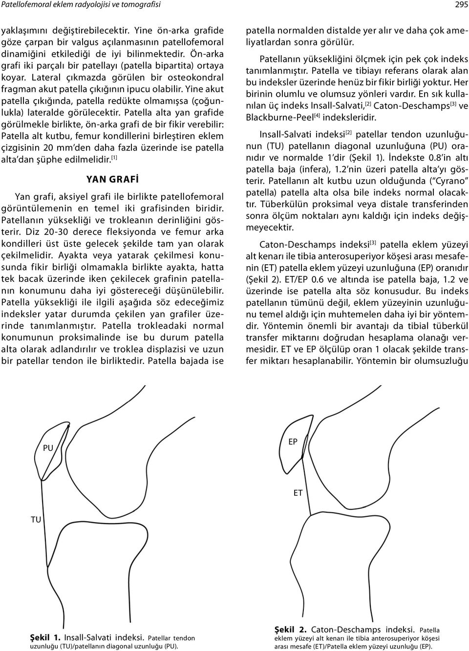 Yine akut patella çıkığında, patella redükte olmamışsa (çoğunlukla) lateralde görülecektir.