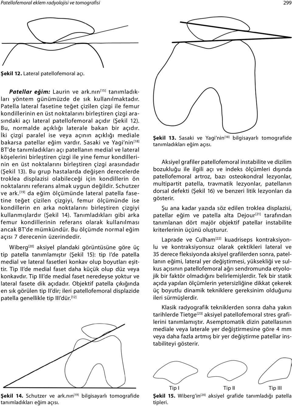 Bu, normalde açıklığı laterale bakan bir açıdır. İki çizgi paralel ise veya açının açıklığı mediale bakarsa patellar eğim vardır.