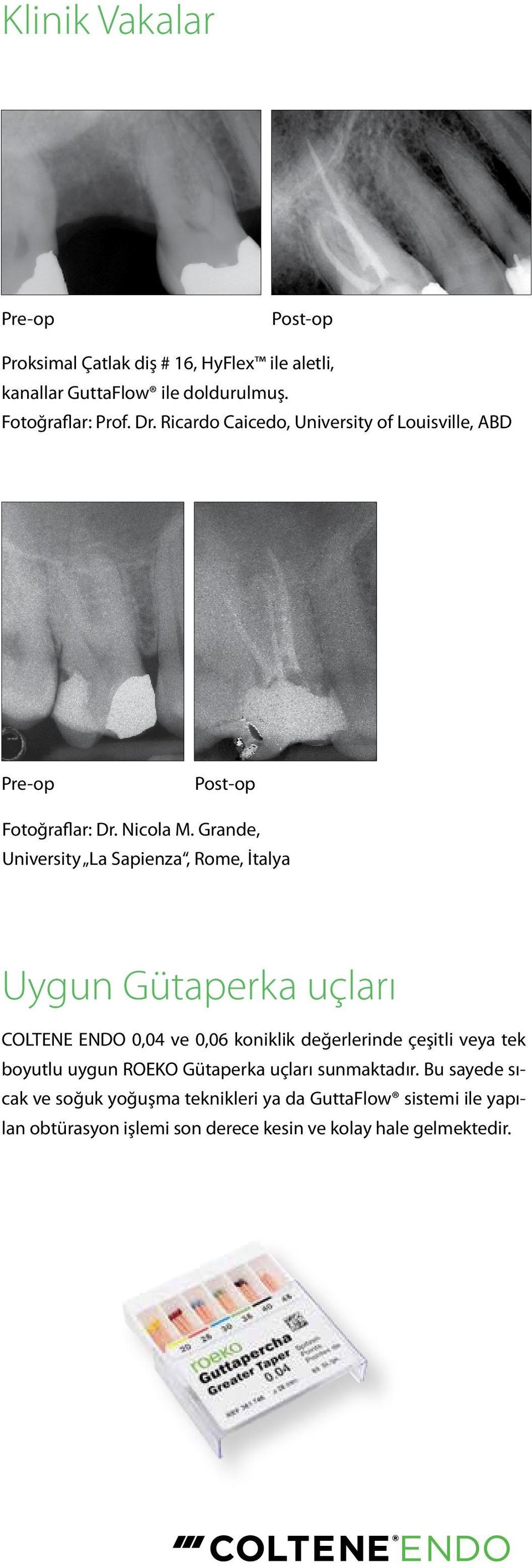 Grande, University La Sapienza, Rome, İtalya Uygun Gütaperka uçları COLTENE ENDO 0,04 ve 0,06 koniklik değerlerinde çeşitli veya tek