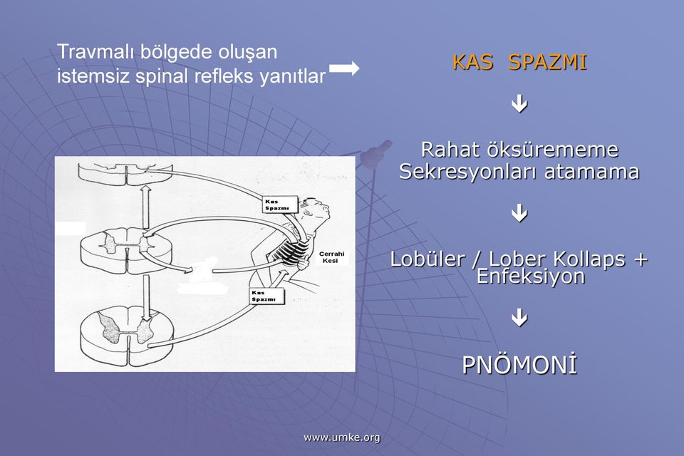 Rahat öksürememe Sekresyonları