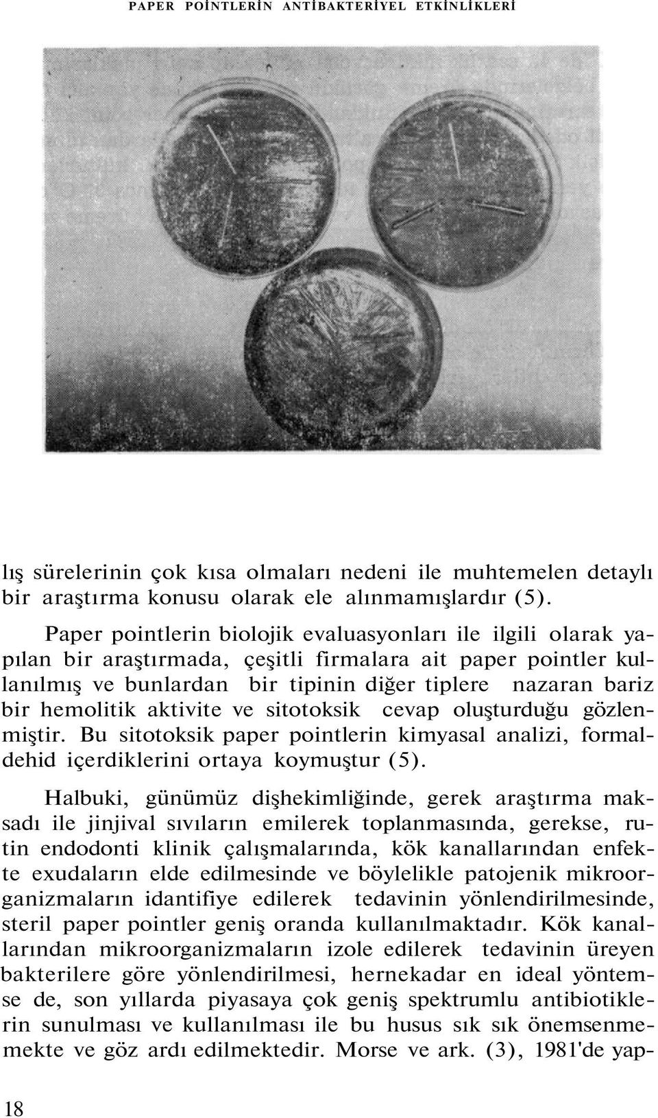 aktivite ve sitotoksik cevap oluşturduğu gözlenmiştir. Bu sitotoksik paper pointlerin kimyasal analizi, formaldehid içerdiklerini ortaya koymuştur (5).