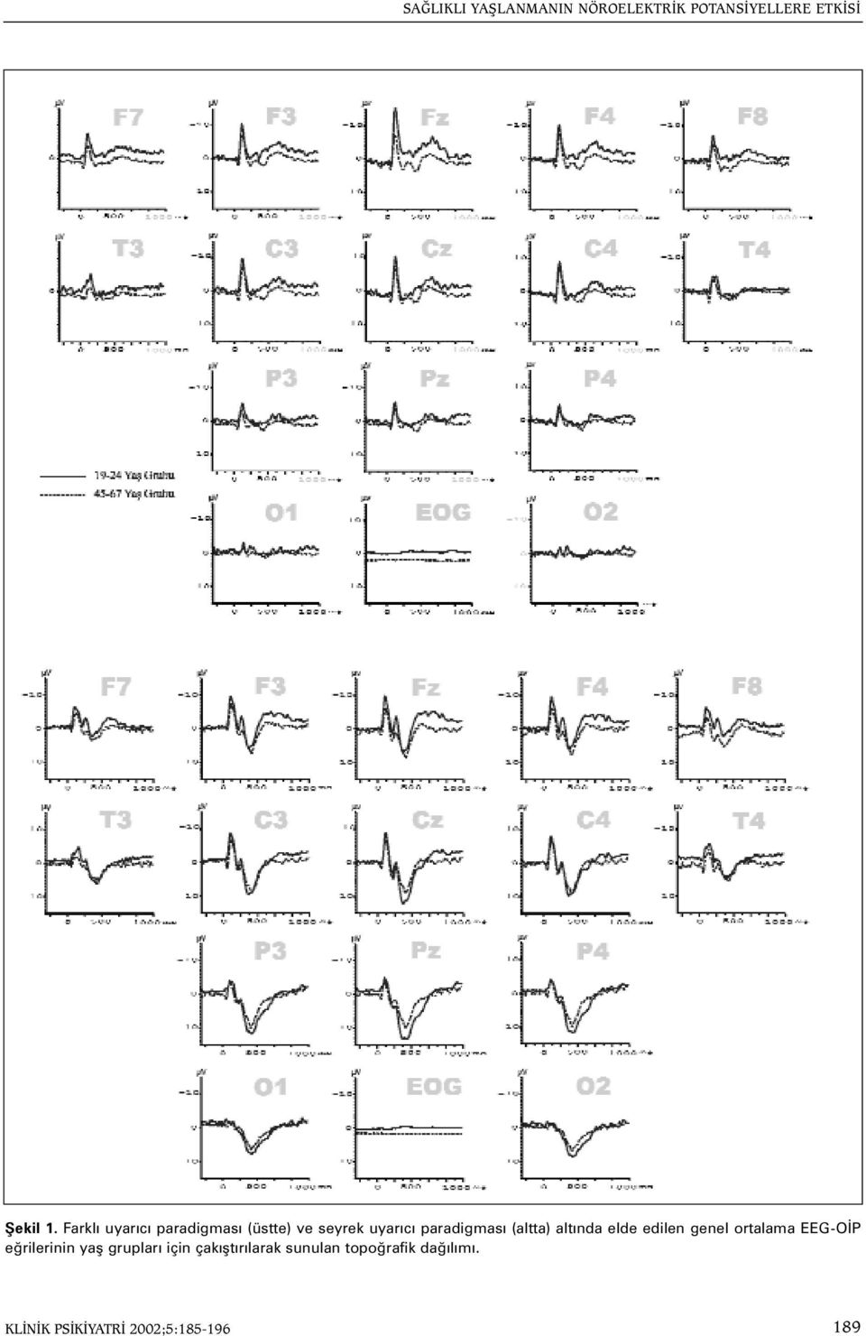 (altta) altýnda elde edilen genel ortalama EEG-OÝP eðrilerinin