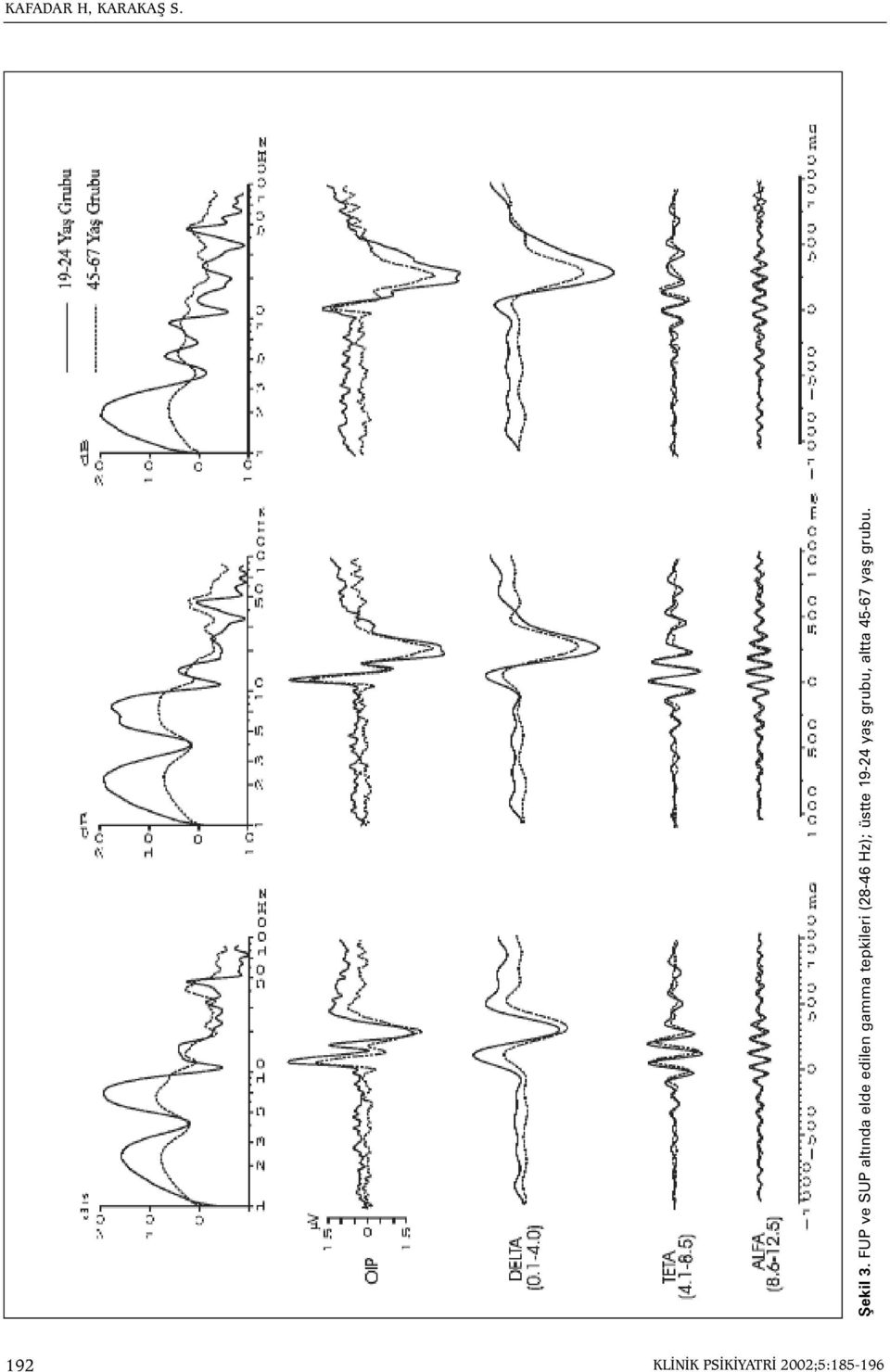 gamma tepkileri (28-46 Hz); üstte