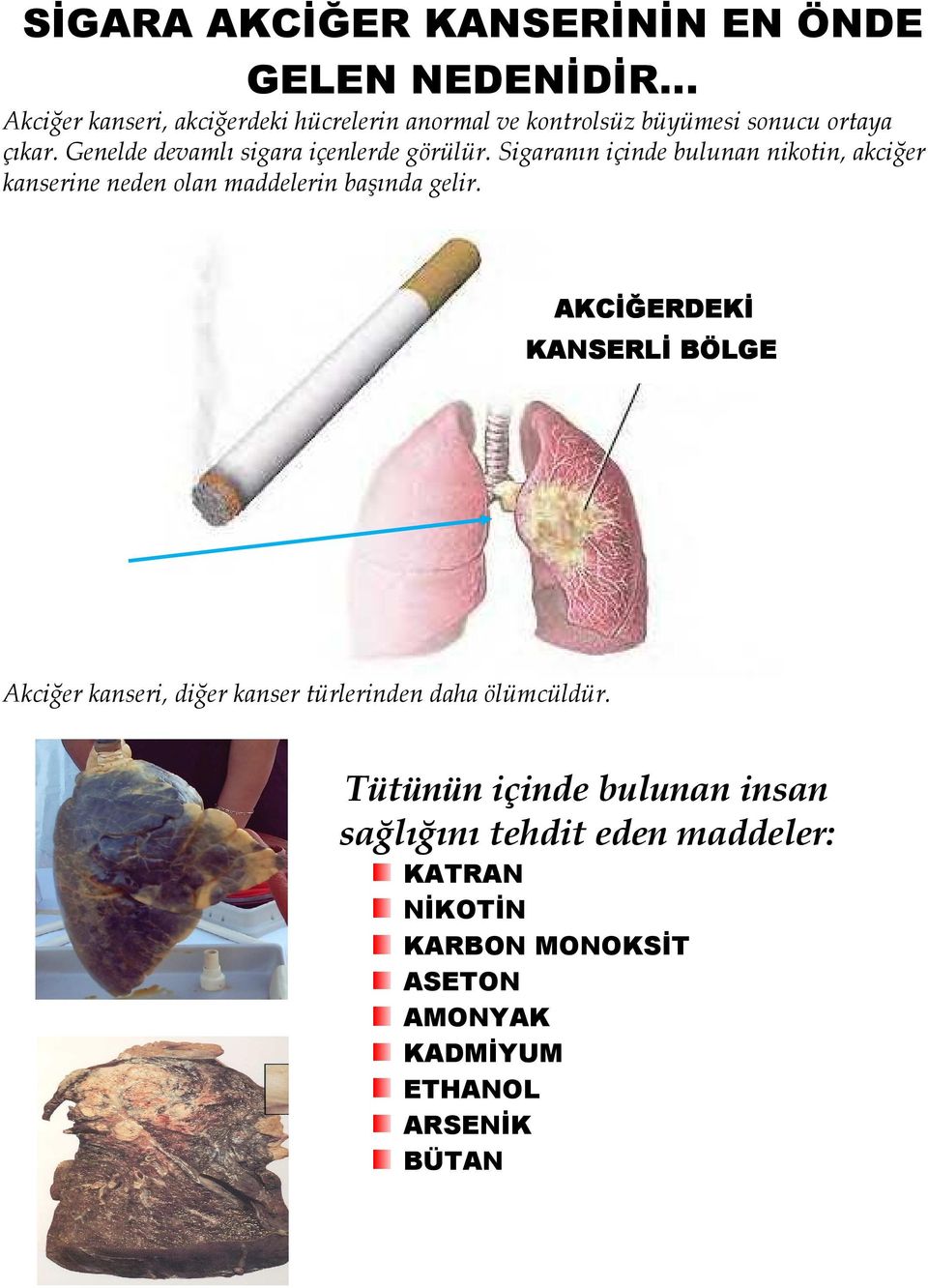 Sigaranın içinde bulunan nikotin, akciğer kanserine neden olan maddelerin başında gelir.