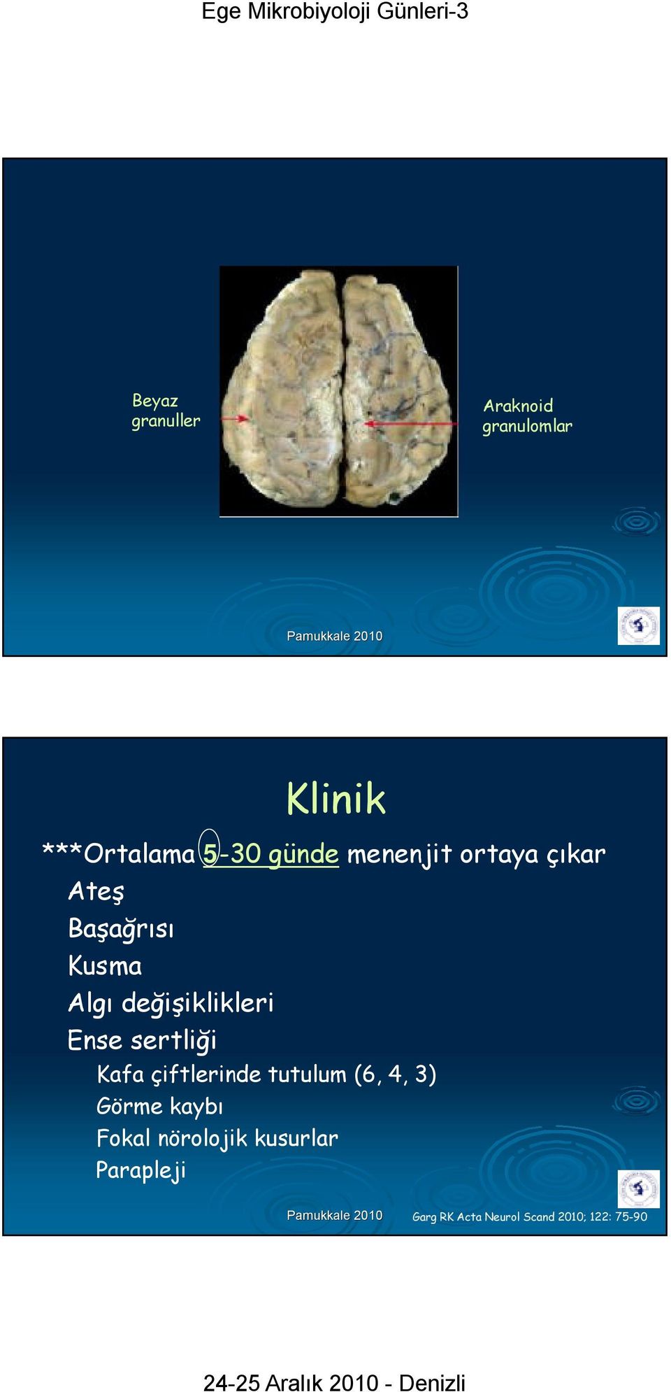 Ense sertliği Kafa çiftlerinde tutulum (6, 4, 3) Görme kaybı Fokal