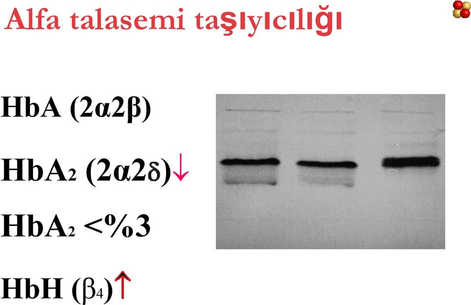 (2α2β) HbA2 (2α2