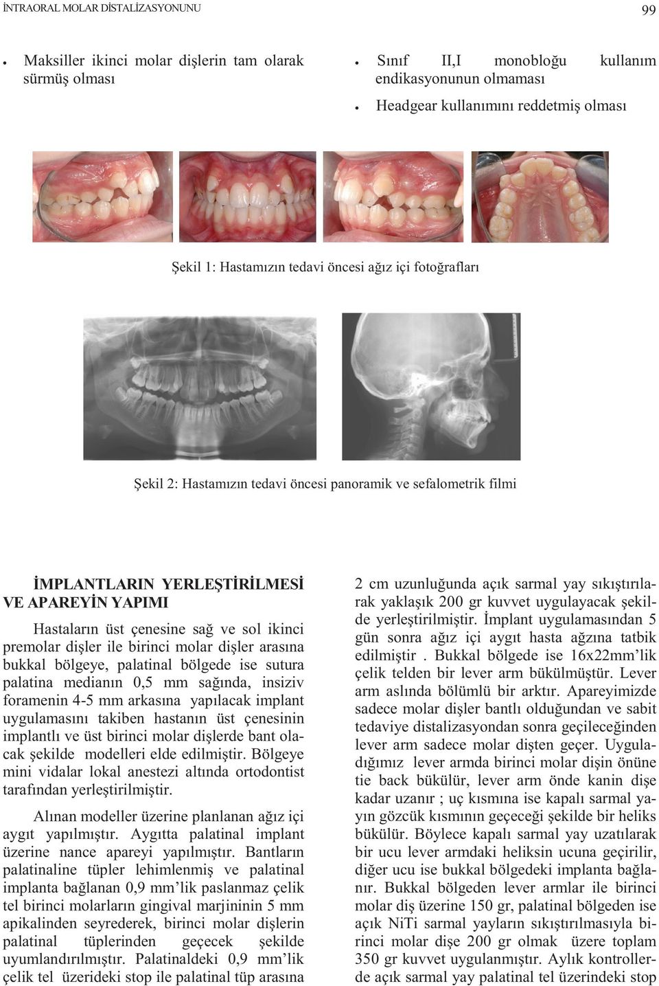 ikinci premolar dişler ile birinci molar dişler arasına bukkal bölgeye, palatinal bölgede ise sutura palatina medianın 0,5 mm sağında, insiziv foramenin 4-5 mm arkasına yapılacak implant uygulamasını