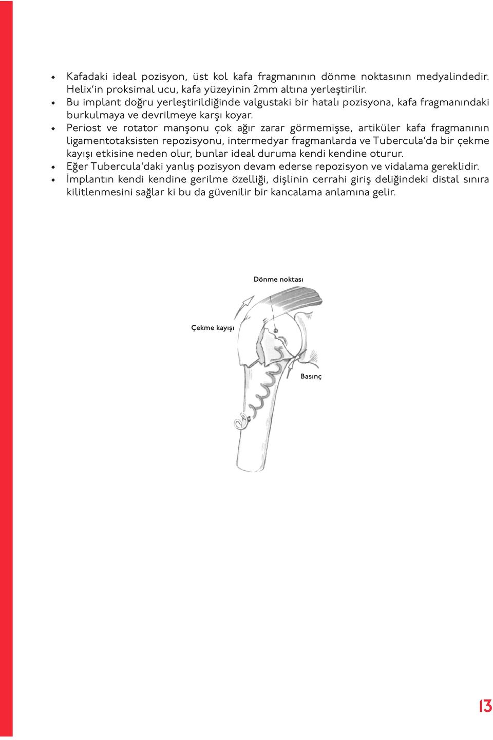 Periost ve rotator manşonu çok ağır zarar görmemişse, artiküler kafa fragmanının ligamentotaksisten repozisyonu, intermedyar fragmanlarda ve Tubercula da bir çekme kayışı etkisine neden olur,