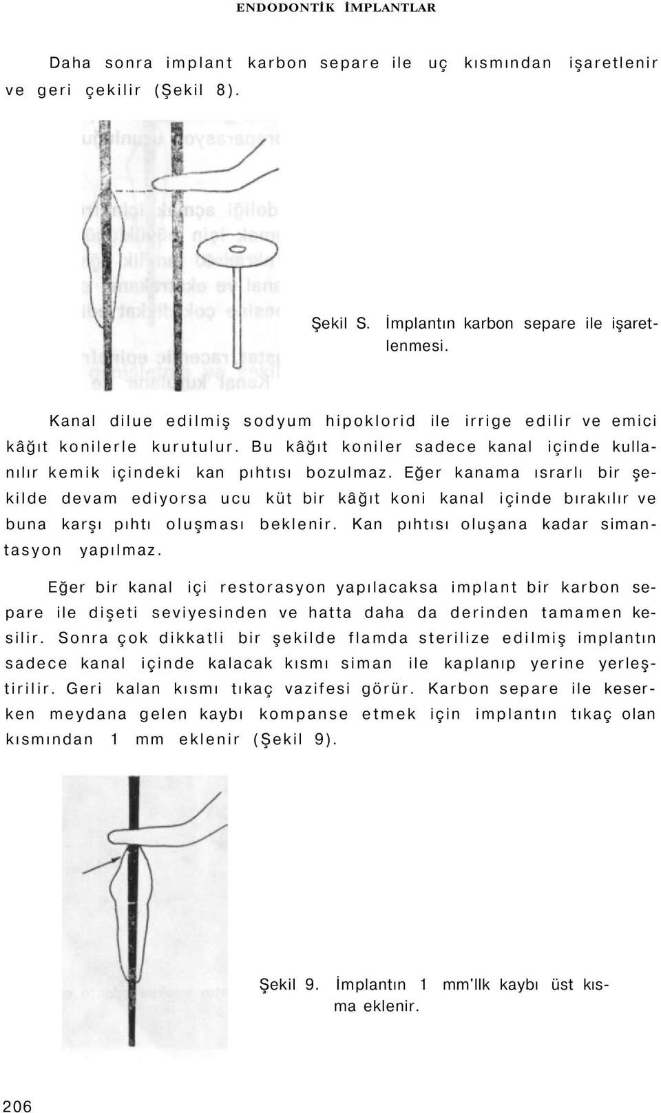 Eğer kanama ısrarlı bir şekilde devam ediyorsa ucu küt bir kâğıt koni kanal içinde bırakılır ve buna karşı pıhtı oluşması beklenir. Kan pıhtısı oluşana kadar simantasyon yapılmaz.