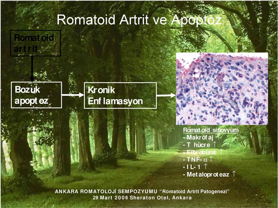 Enflamasyon Romatoid sinovyum