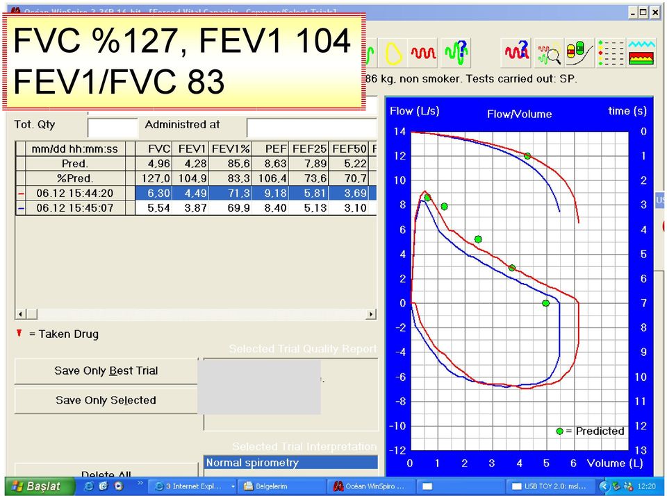 FEV1/FVC