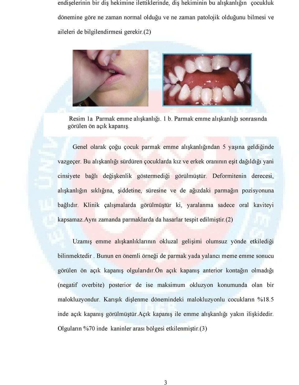 Bu alışkanlığı sürdüren çocuklarda kız ve erkek oranının eşit dağıldığı yani cinsiyete bağlı değişkenlik göstermediği görülmüştür.