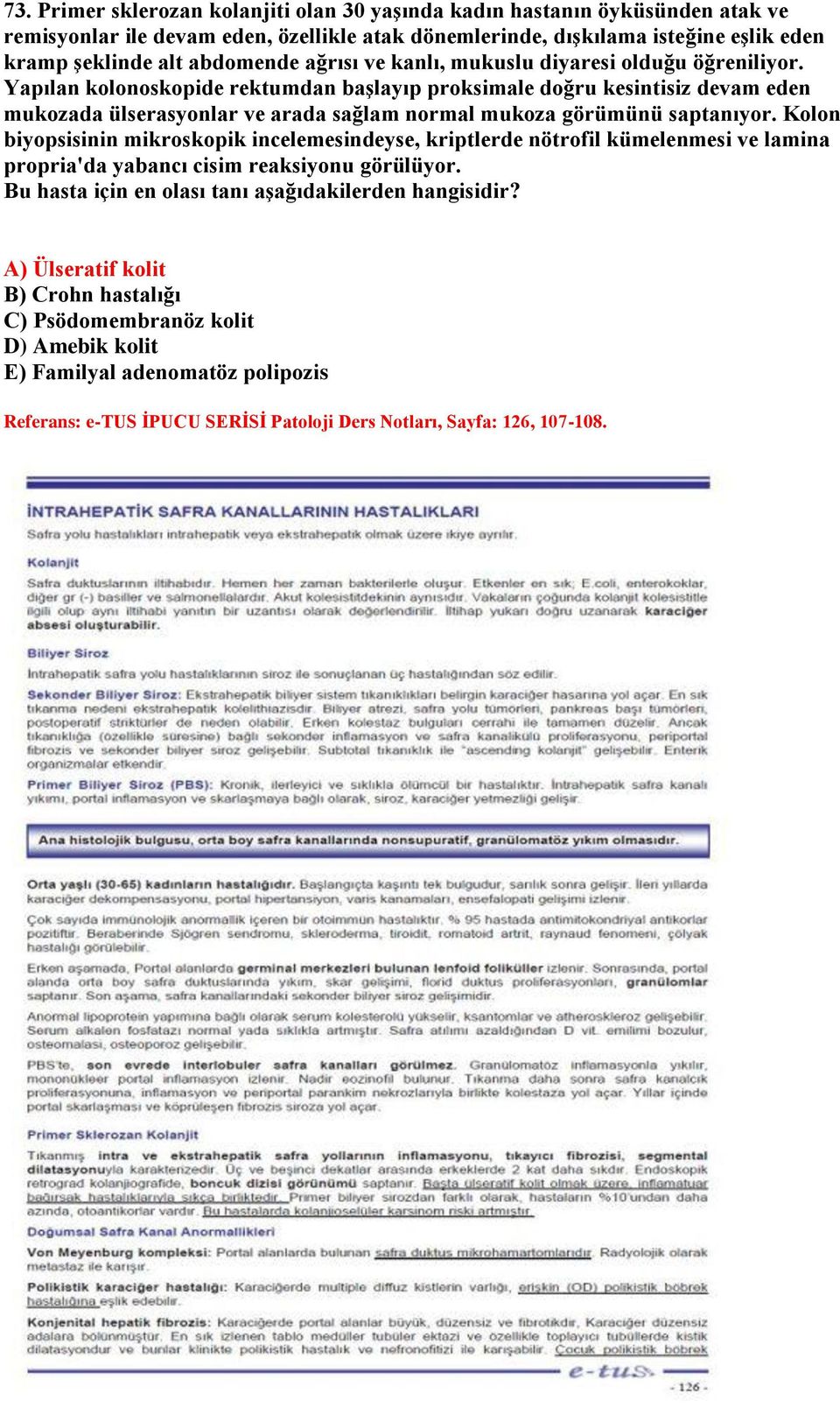 Yapılan kolonoskopide rektumdan başlayıp proksimale doğru kesintisiz devam eden mukozada ülserasyonlar ve arada sağlam normal mukoza görümünü saptanıyor.