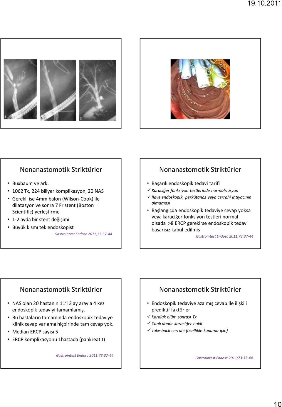 endoskopist Gastrointest Endosc 2011;73:37-44 Başarılı endoskopik tedavi tarifi Karaciğer fonksiyon testlerinde normalizasyon İlave endoskopik, perkütanöz veya cerrahi ihtiyacının olmaması