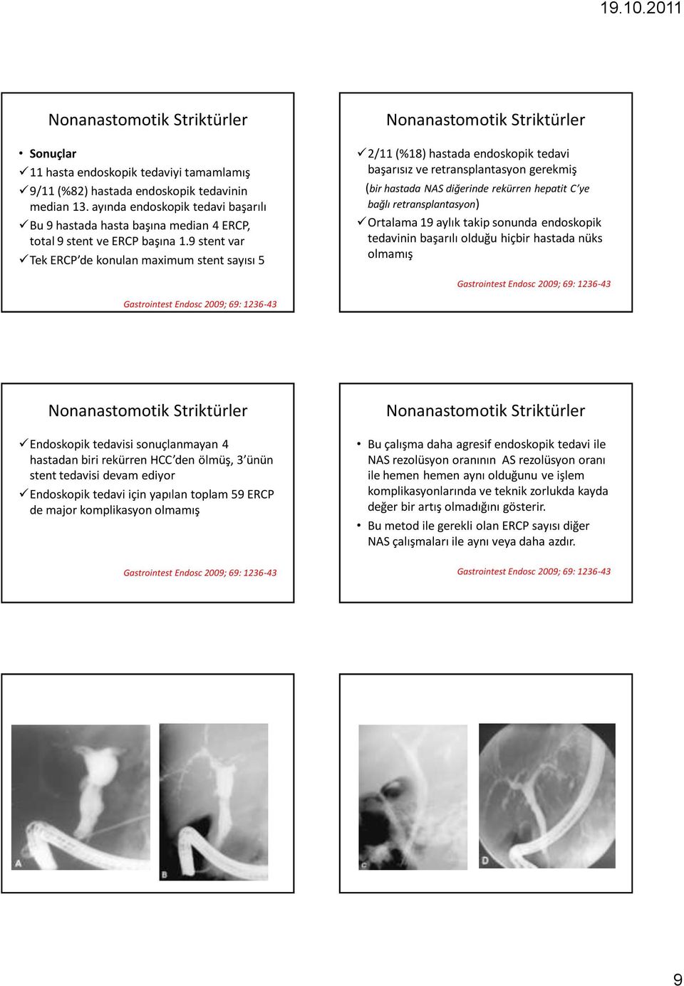 9 stent var Tek ERCP de konulan maximum stent sayısı 5 2/11 (%18) hastada endoskopik tedavi başarısız ve retransplantasyon gerekmiş (bir hastada NAS diğerinde rekürren hepatit C ye bağlı