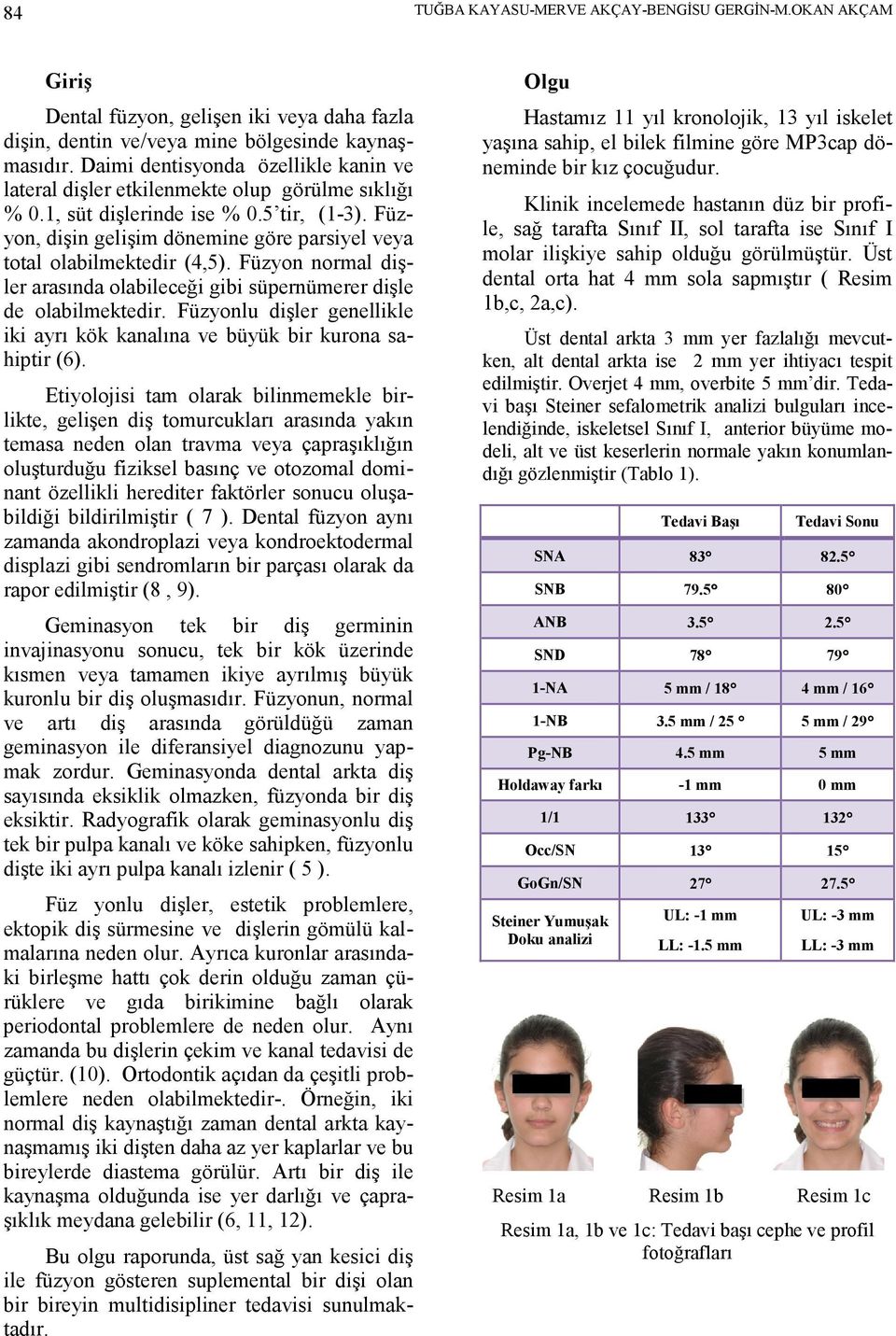 Füzyon, dişin gelişim dönemine göre parsiyel veya total olabilmektedir (4,5). Füzyon normal dişler arasında olabileceği gibi süpernümerer dişle de olabilmektedir.