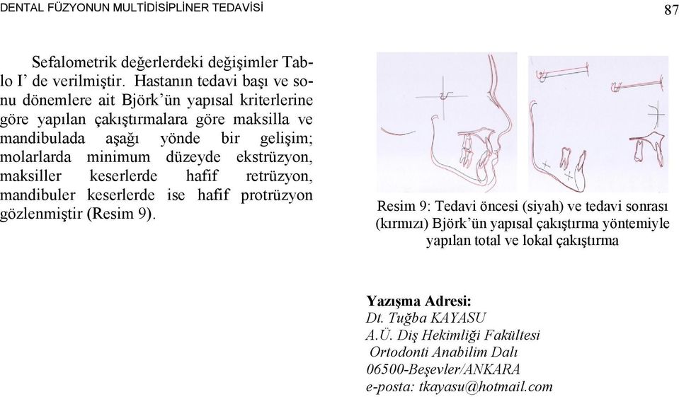 minimum düzeyde ekstrüzyon, maksiller keserlerde hafif retrüzyon, mandibuler keserlerde ise hafif protrüzyon gözlenmiştir (Resim 9).