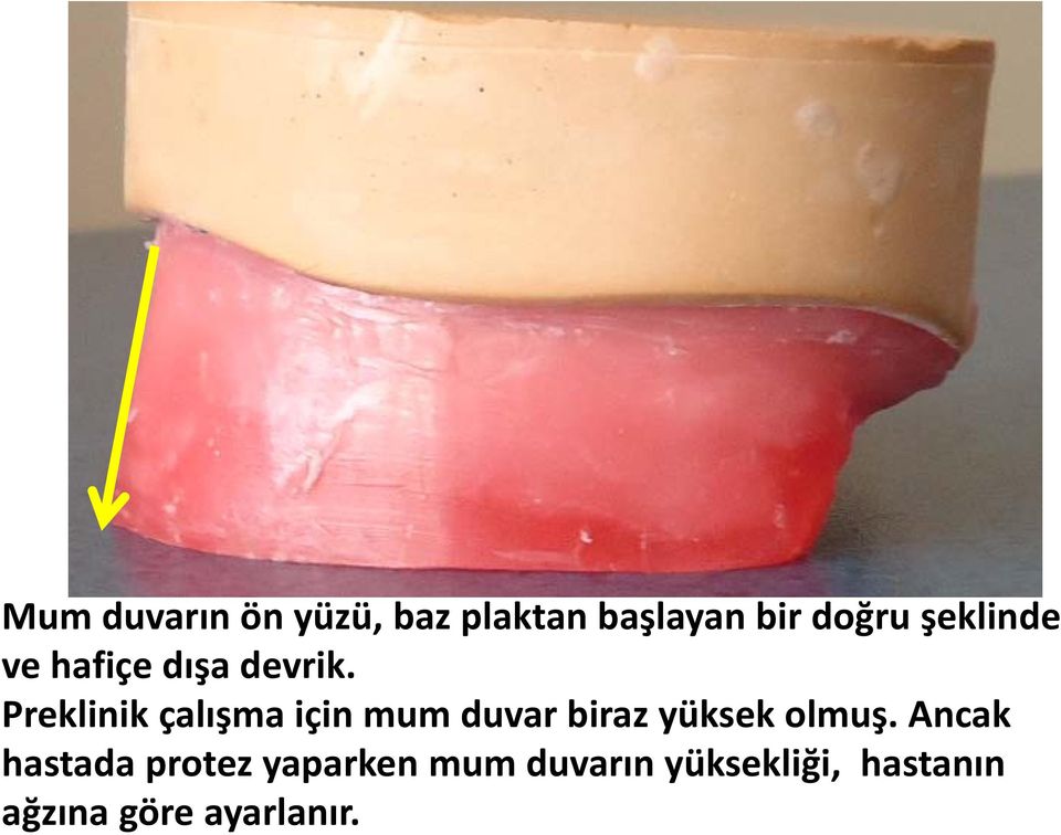 Preklinik çalışma için mum duvar biraz yüksek olmuş.