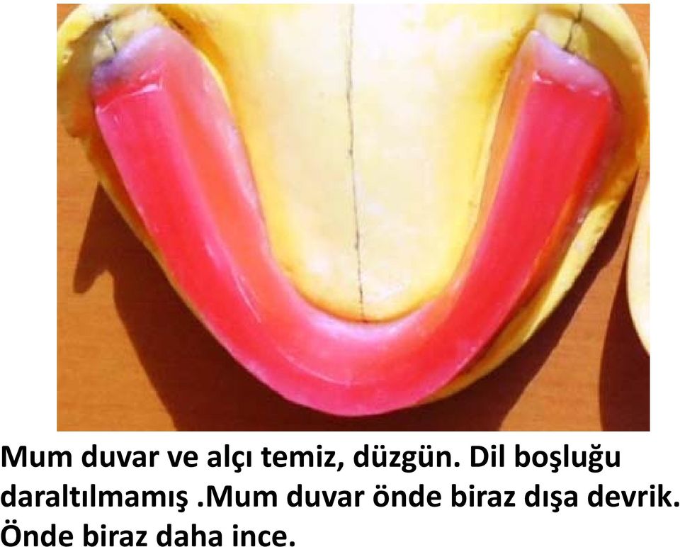 Dil boşluğu daraltılmamış.