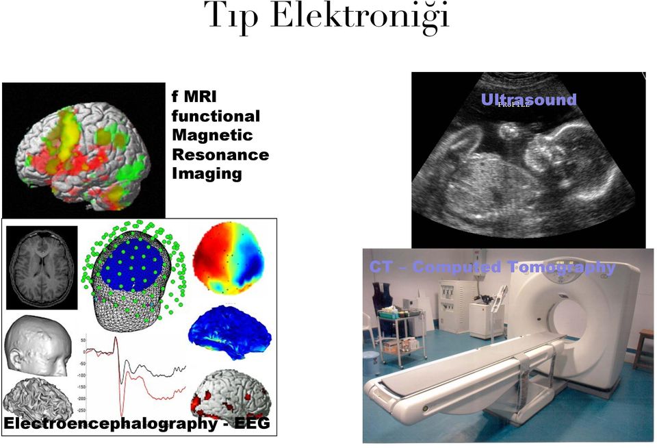 Imaging Ultrasound CT Computed