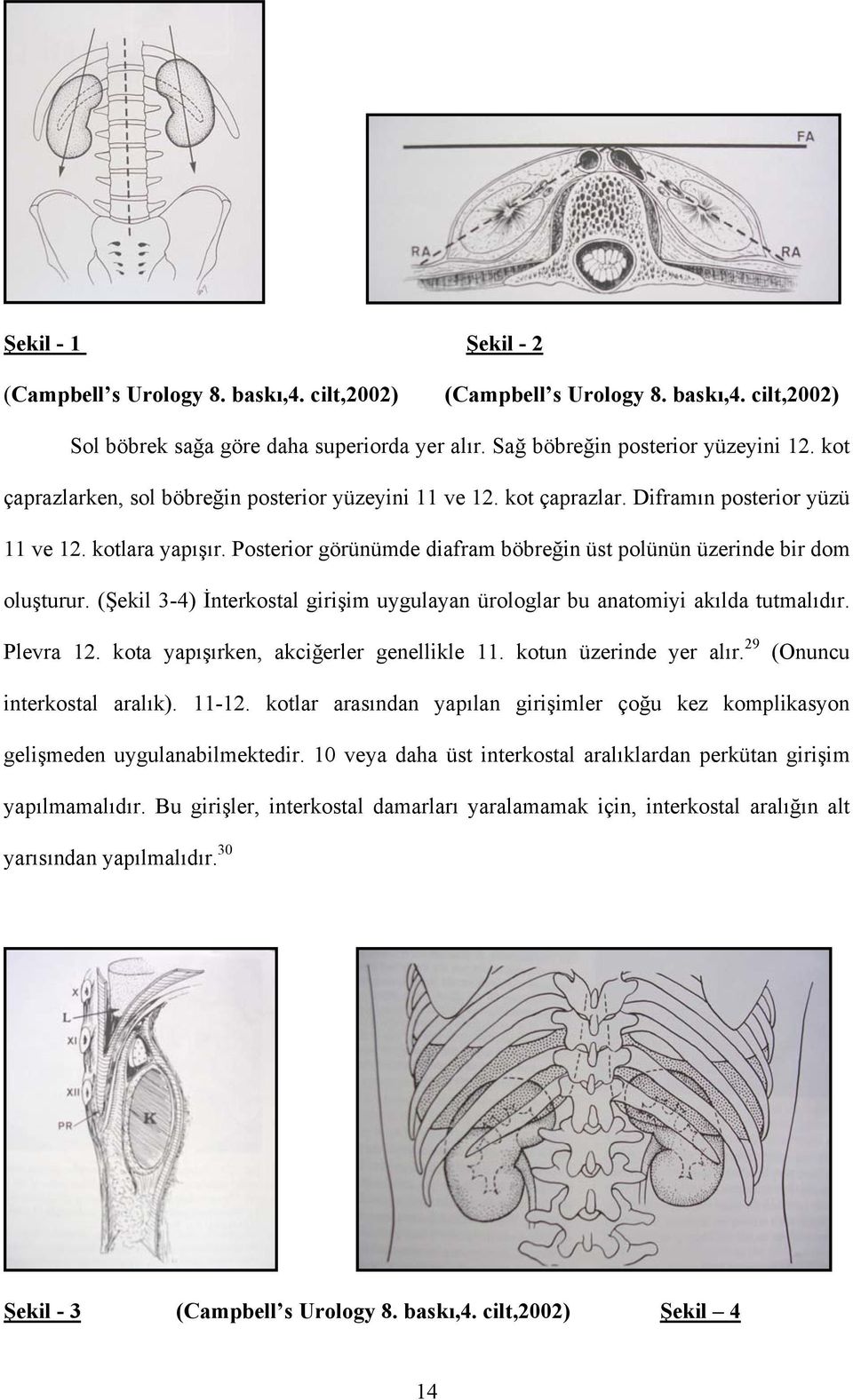 Posterior görünümde diafram böbreğin üst polünün üzerinde bir dom oluşturur. (Şekil 3-4) İnterkostal girişim uygulayan ürologlar bu anatomiyi akılda tutmalıdır. Plevra 12.
