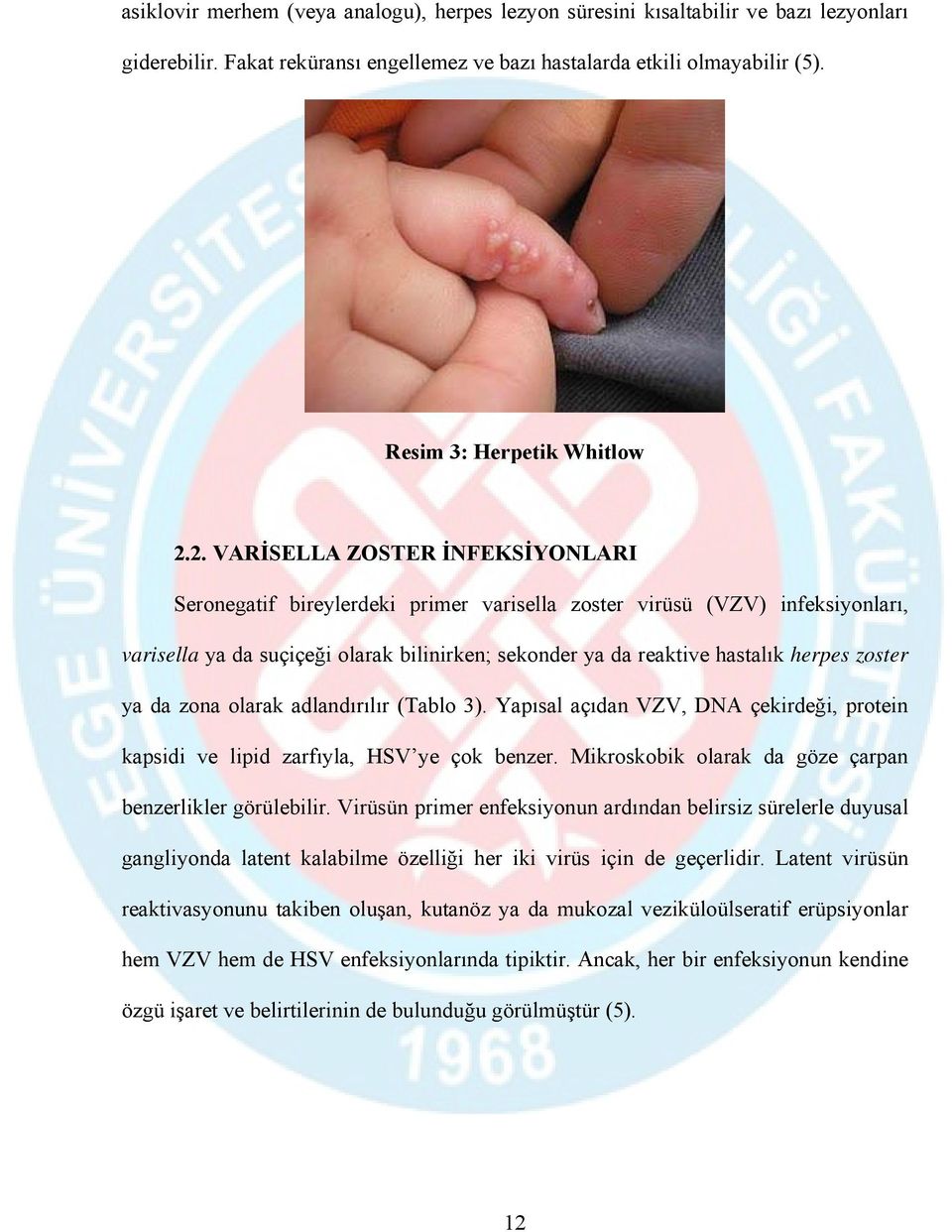 zoster ya da zona olarak adlandırılır (Tablo 3). Yapısal açıdan VZV, DNA çekirdeği, protein kapsidi ve lipid zarfıyla, HSV ye çok benzer. Mikroskobik olarak da göze çarpan benzerlikler görülebilir.