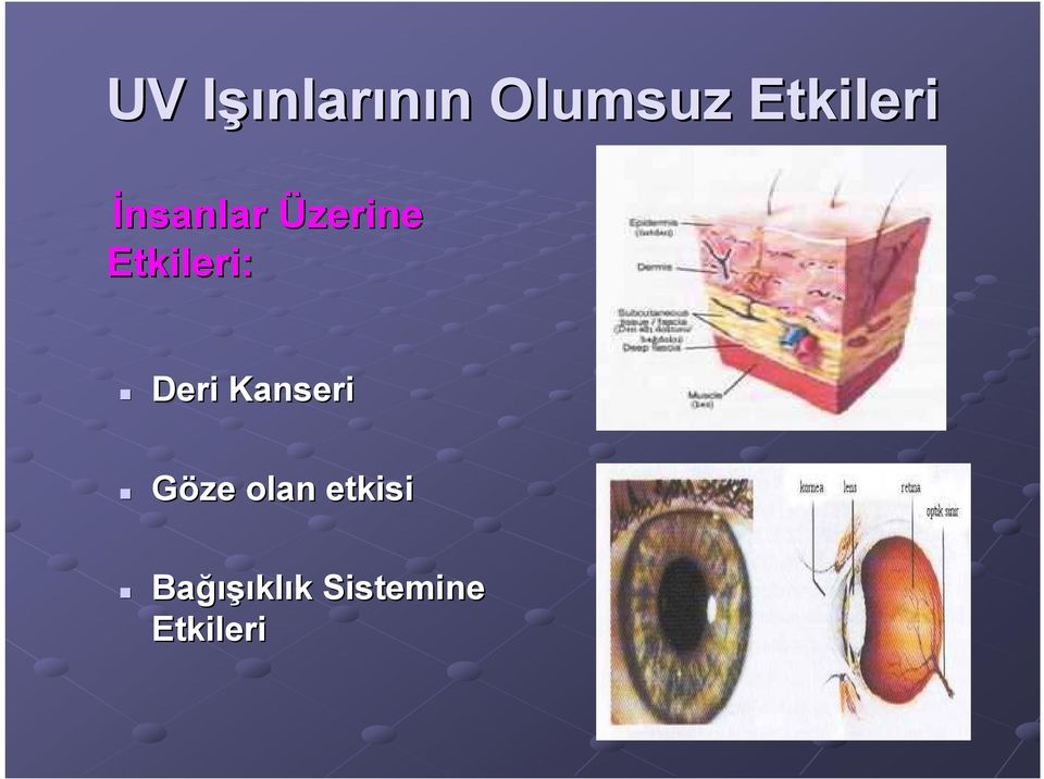 Etkileri: Deri Kanseri Göze olan