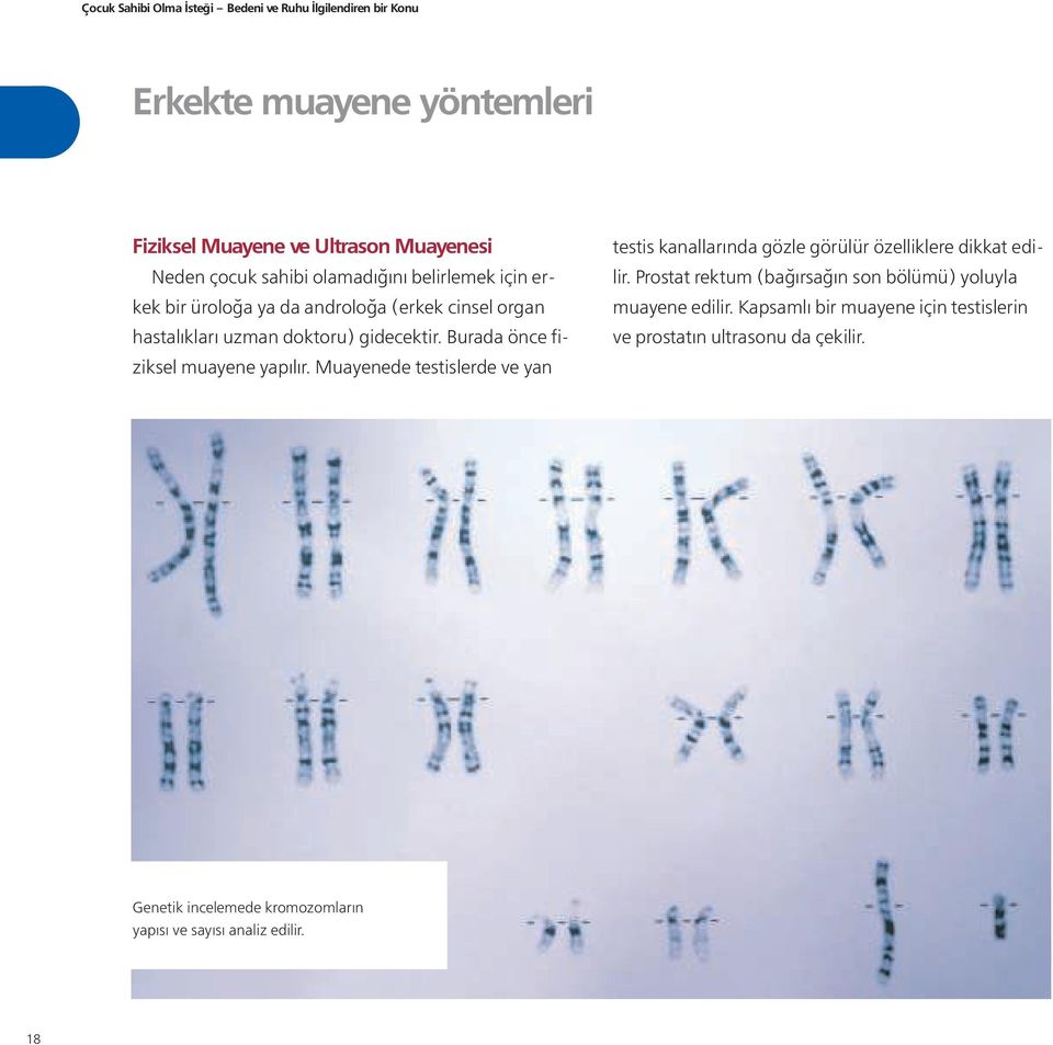 Muayenede testislerde ve yan testis kanallarında gözle görülür özelliklere dikkat edilir.