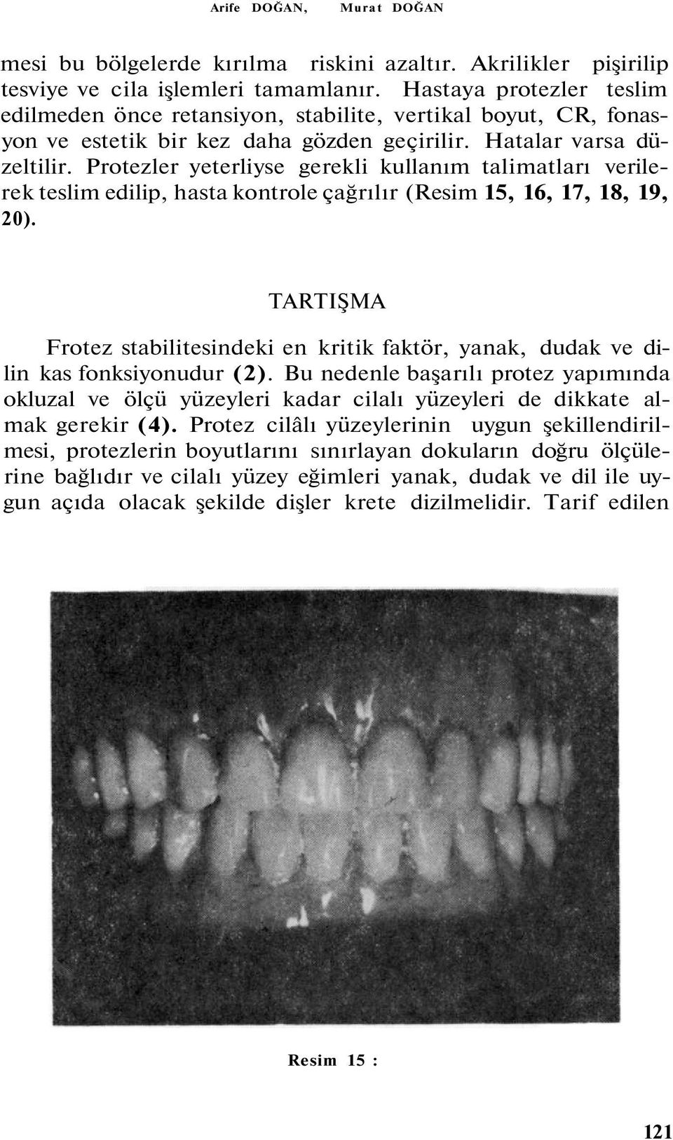 Protezler yeterliyse gerekli kullanım talimatları verilerek teslim edilip, hasta kontrole çağrılır (Resim 15, 16, 17, 18, 19, 20).