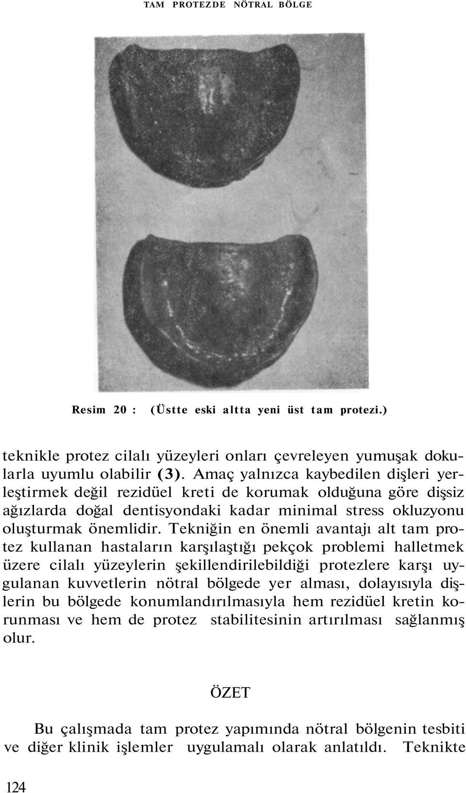 Tekniğin en önemli avantajı alt tam protez kullanan hastaların karşılaştığı pekçok problemi halletmek üzere cilalı yüzeylerin şekillendirilebildiği protezlere karşı uygulanan kuvvetlerin nötral