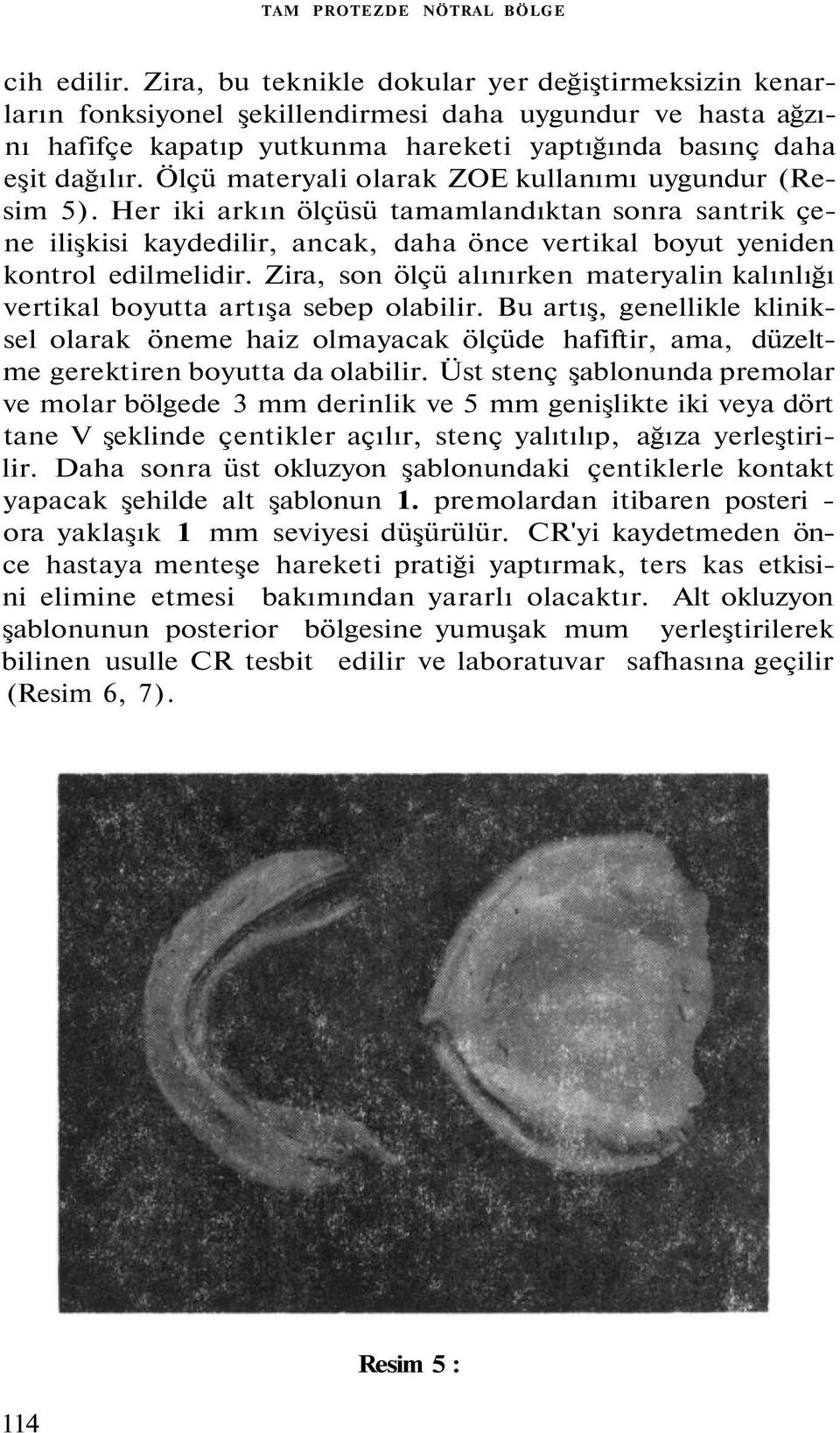 Ölçü materyali olarak ZOE kullanımı uygundur (Resim 5). Her iki arkın ölçüsü tamamlandıktan sonra santrik çene ilişkisi kaydedilir, ancak, daha önce vertikal boyut yeniden kontrol edilmelidir.