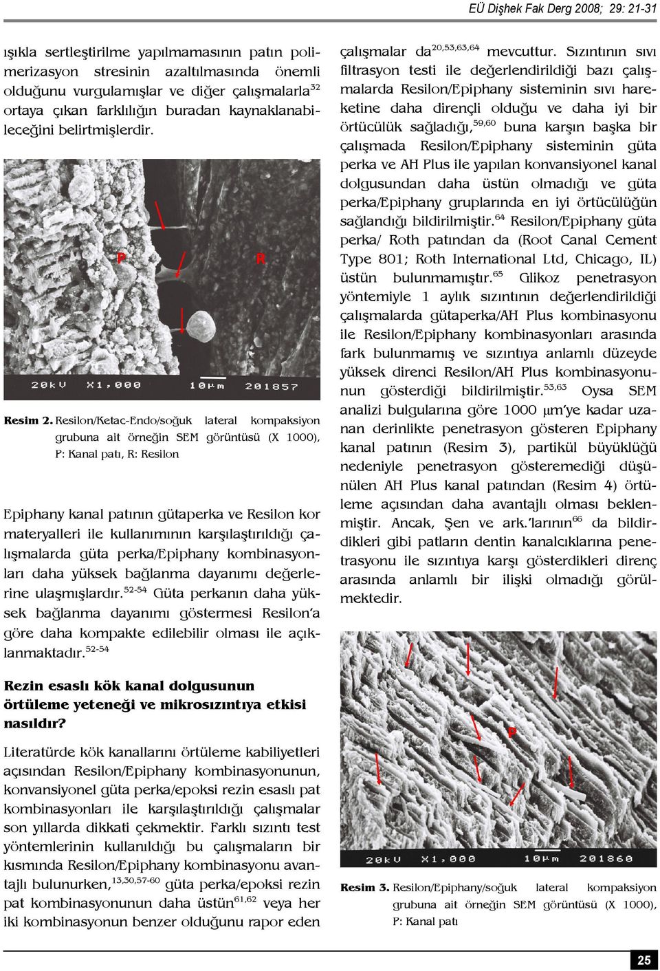 Resilon/Ketac-Endo/soğuk lateral kompaksiyon grubuna ait örneğin SEM görüntüsü (X 1000), P: Kanal patı, R: Resilon Epiphany kanal patının gütaperka ve Resilon kor materyalleri ile kullanımının