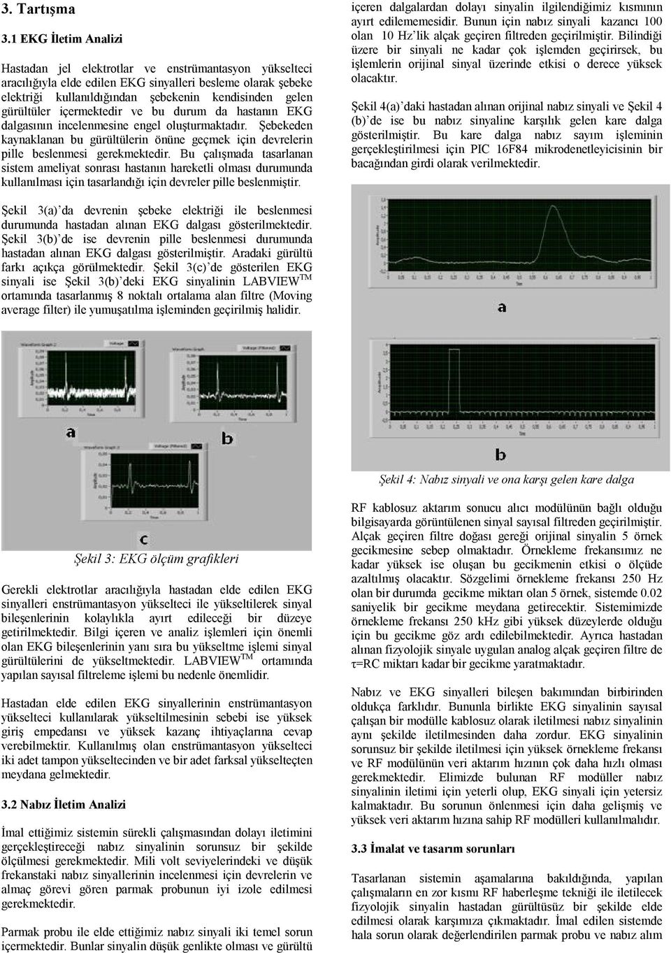 gürültüler içermektedir ve bu durum da hastanın EKG dalgasının incelenmesine engel oluşturmaktadır. Şebekeden kaynaklanan bu gürültülerin önüne geçmek için devrelerin pille beslenmesi gerekmektedir.