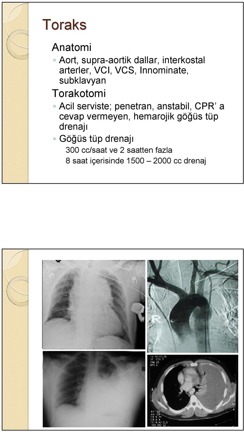 anstabil, CPR a cevap vermeyen, hemarojik göğüs tüp drenajı Göğüs tüp