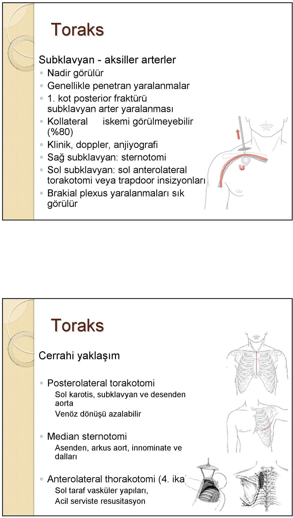 subklavyan: sol anterolateral torakotomi veya trapdoor insizyonları Brakial plexus yaralanmaları sık görülür Toraks Cerrahi yaklaşım Posterolateral