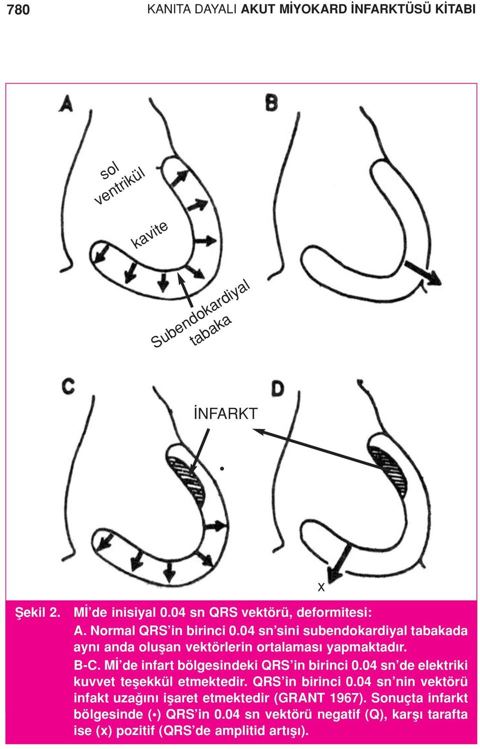 04 sn sini subendokardiyal tabakada ayn anda oluflan vektörlerin ortalamas yapmaktad r. B-C. M de infart bölgesindeki QRS in birinci 0.