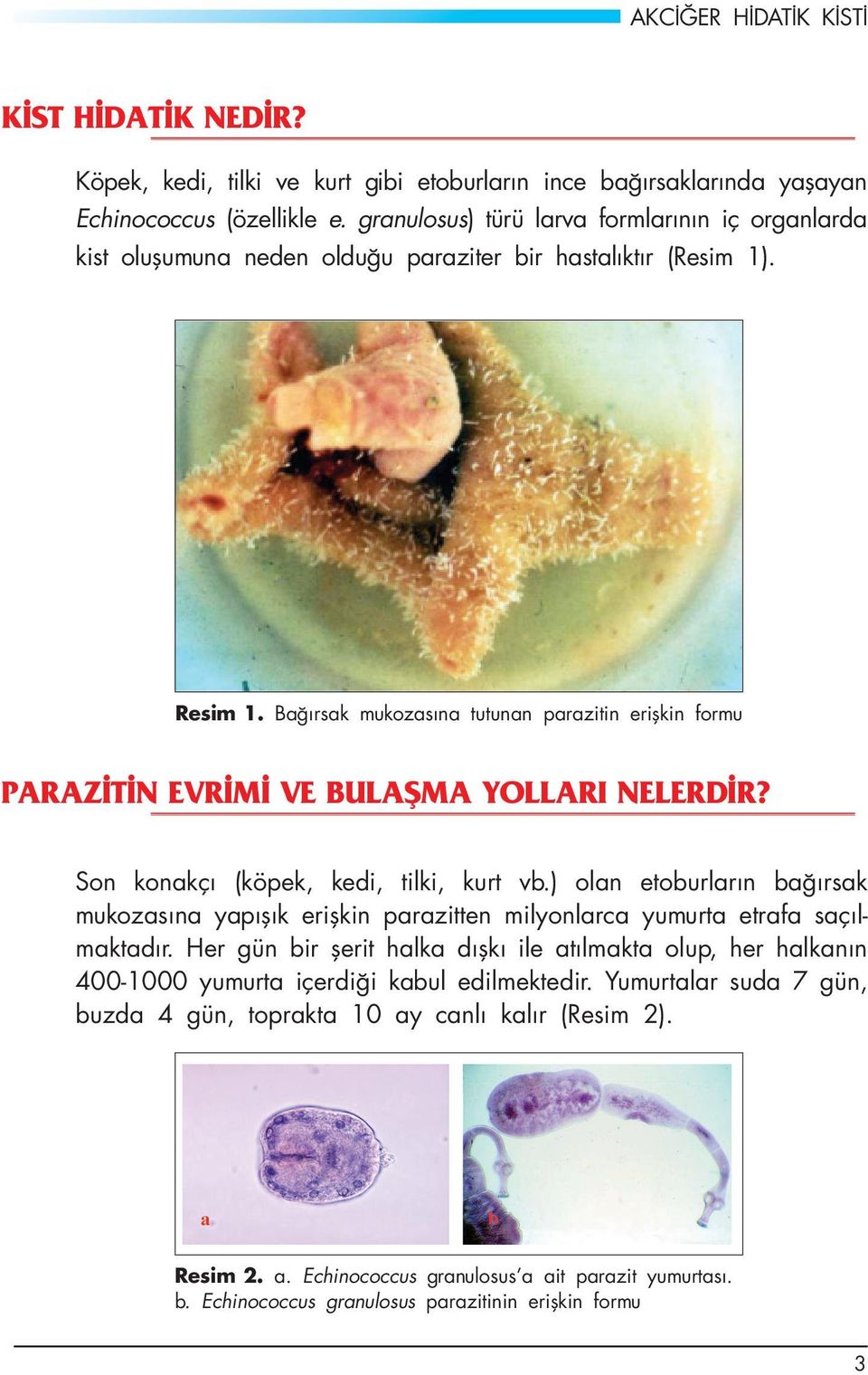 Bağırsak mukozasına tutunan parazitin erişkin formu PARAZİTİN EVRİMİ VE BULAŞMA YOLLARI NELERDİR? Son konakçı (köpek, kedi, tilki, kurt vb.