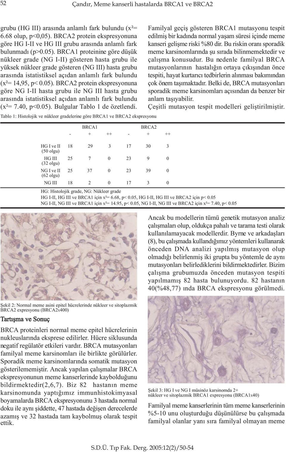 BRCA1 proteinine göre düþük nükleer grade (NG I-II) gösteren hasta grubu ile yüksek nükleer grade gösteren (NG III) hasta grubu arasýnda istatistiksel açýdan anlamlý fark bulundu (x²= 14,95, p< 0.05).