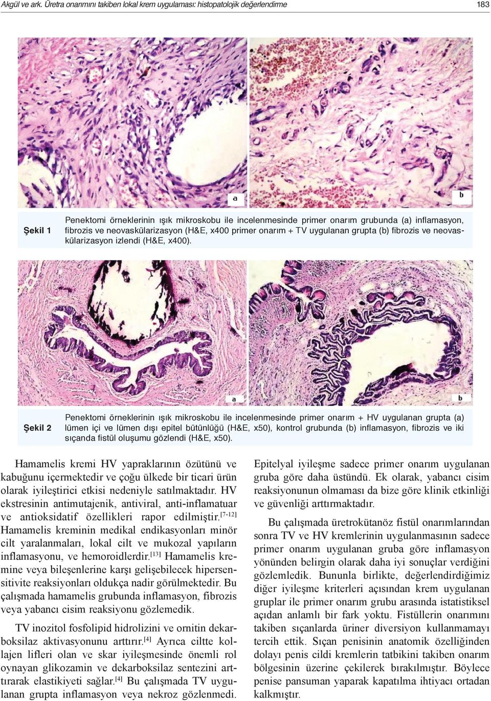 neovaskülarizasyon (H&E, x400 primer onarım + TV uygulanan grupta (b) fibrozis ve neovaskülarizasyon izlendi (H&E, x400).