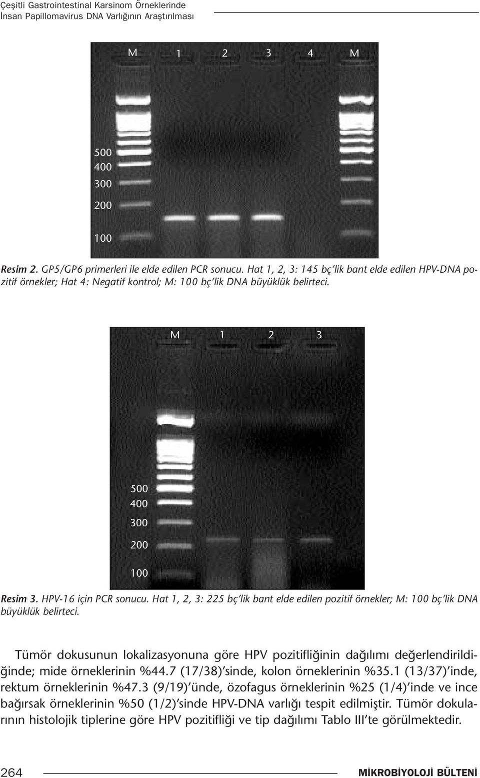 Hat 1, 2, 3: 225 bç lik bant elde edilen pozitif örnekler; : 100 bç lik DNA büyüklük belirteci.