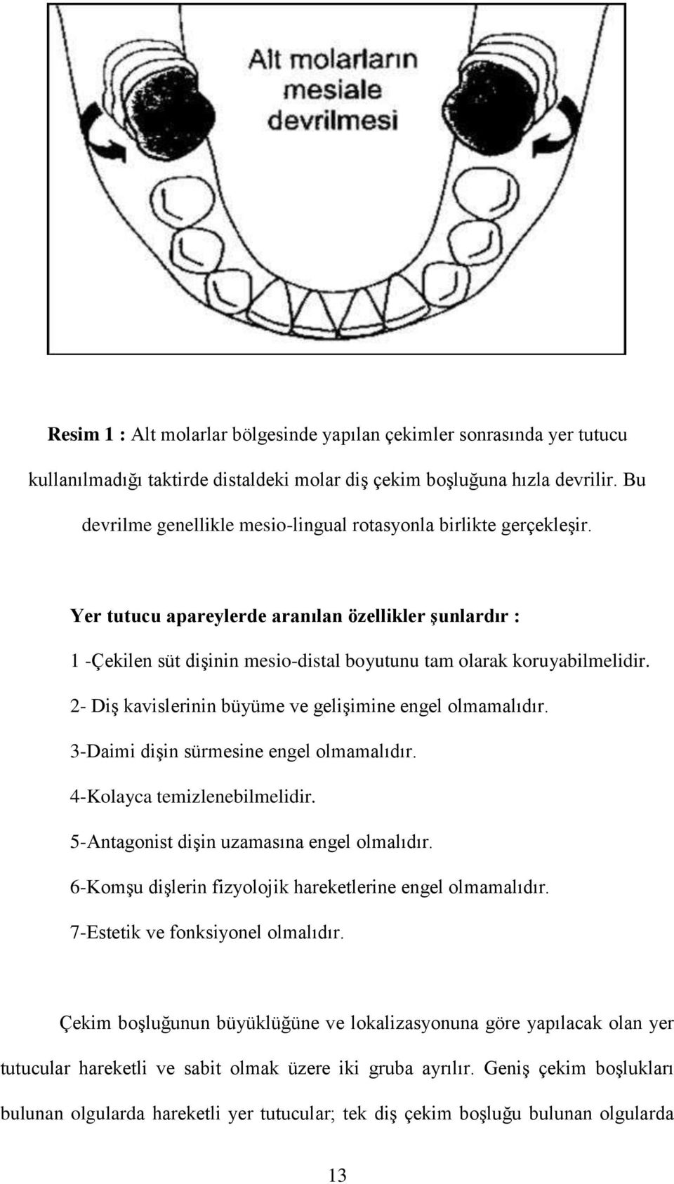 2- Diş kavislerinin büyüme ve gelişimine engel olmamalıdır. 3-Daimi dişin sürmesine engel olmamalıdır. 4-Kolayca temizlenebilmelidir. 5-Antagonist dişin uzamasına engel olmalıdır.